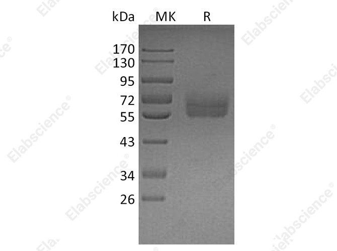 Recombinant Human TYRO3 Protein (His Tag) - 1