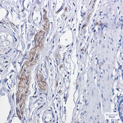 Recombinant Phospho-PKCα (Thr638) Monoclonal Antibody - 3