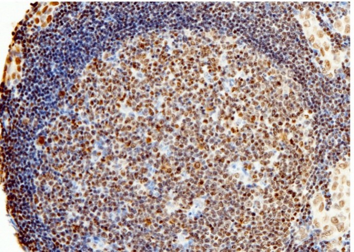 PARP-1/PARP Monoclonal Antibody - small - 2