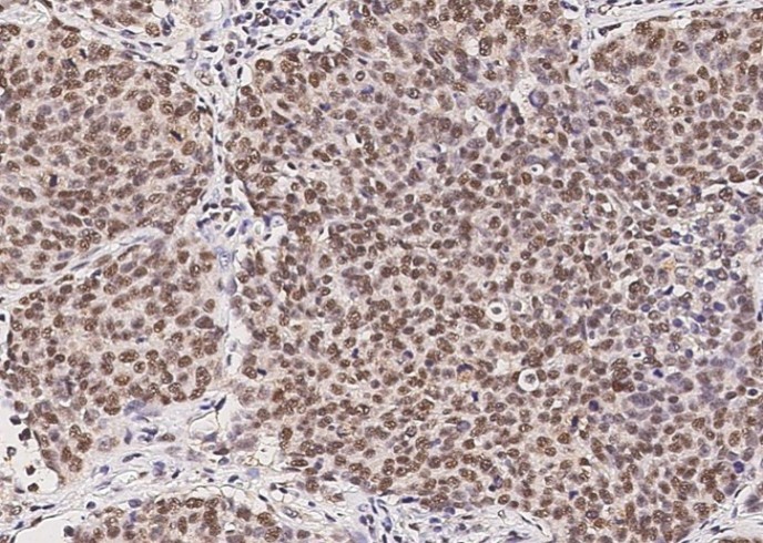 RPRD1B Monoclonal Antibody - small - 2