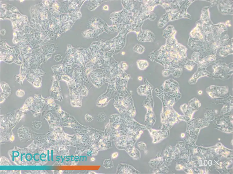 MDA-MB-175VII (DMEM) Cell Complete Medium - 1