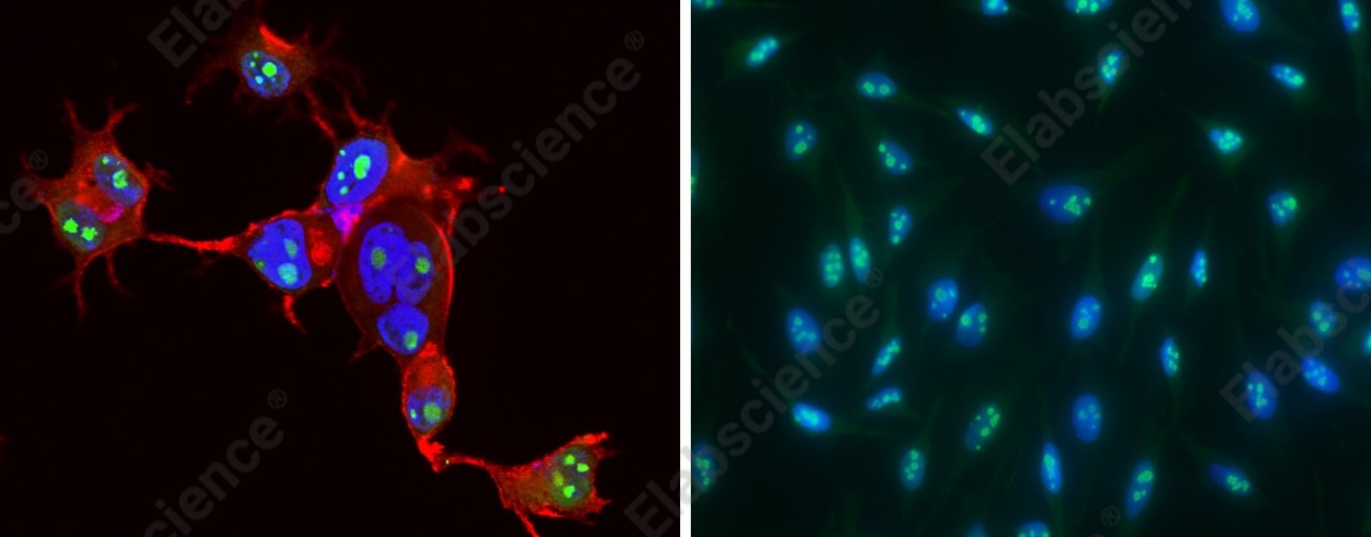 CCNE1/Cyclin-E1 Monoclonal Antibody - 1