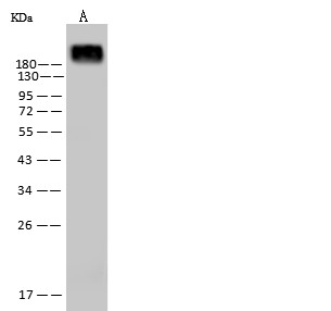 CD45/PTPRC Monoclonal Antibody - small - 3