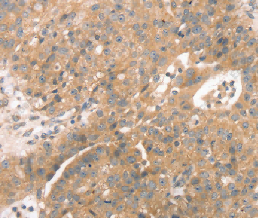STX10 Polyclonal Antibody - 3