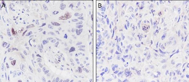 Recombinant Histone H2B (Ubiquityl Lys120) Monoclonal Antibody - 2
