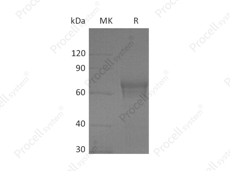 IL-15RA/CD215 (C-Fc), Human, Recombinant