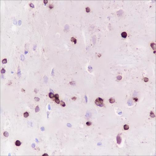 Recombinant Alpha B Crystallin Monoclonal Antibody - small - 6