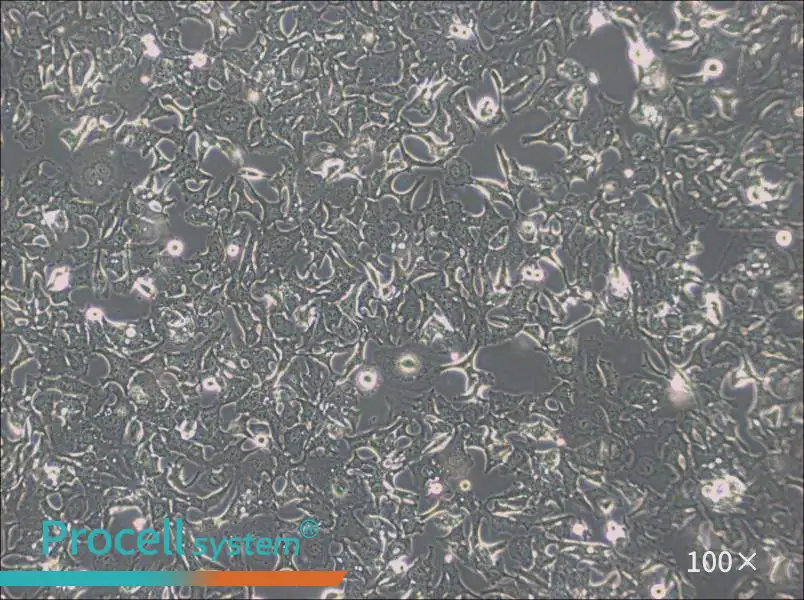 HCC1954 Cell Complete MediumHCC1954 Cell Complete Medium - 2