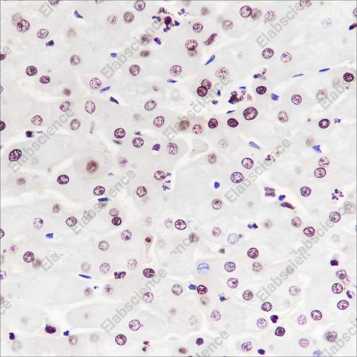 Recombinant NPM1 Monoclonal Antibody - 2