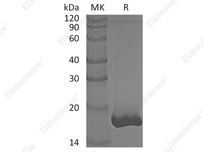Recombinant Human GMFB Protein (His Tag) - 1