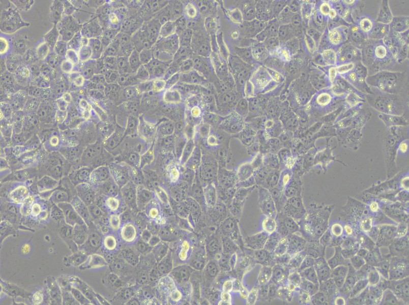 NCI-H1915 Cell Complete Medium - small - 4