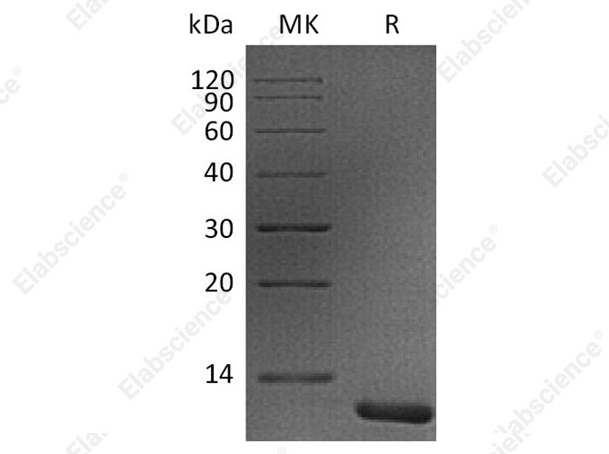 Recombinant Human S100A11 Protein - 1