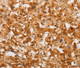 THOC7 Polyclonal Antibody - 2