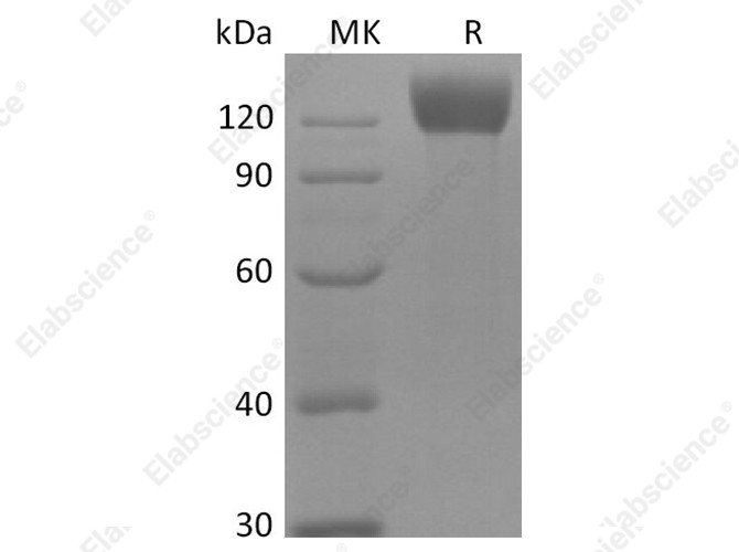 Recombinant Mouse APN Protein (His Tag) - 1