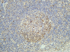 Recombinant FLCN Monoclonal Antibody - 1