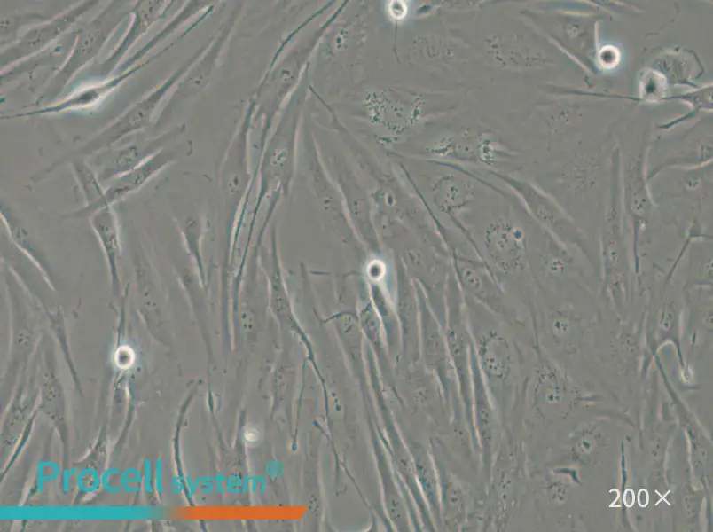 FTC-133 Cell Complete Medium - small - 4