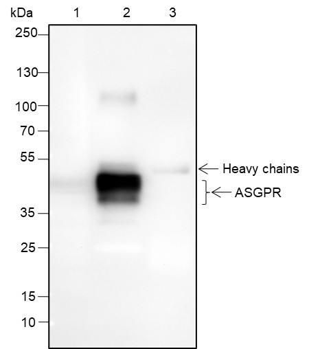 Recombinant ASGR1 Monoclonal Antibody - 2