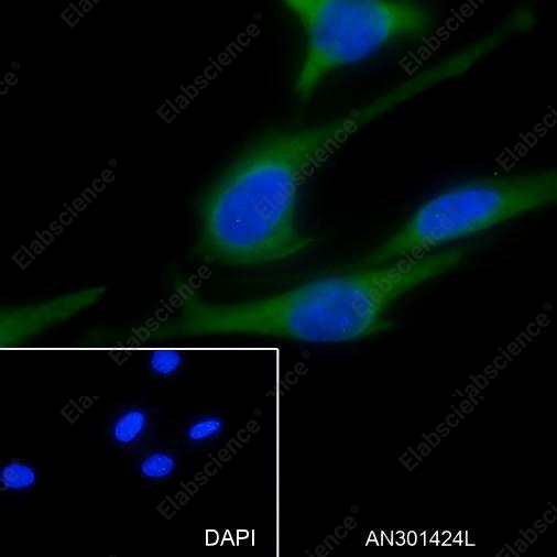 Recombinant ABCE1 Monoclonal Antibody - 3