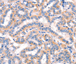 AMY2A Polyclonal Antibody - 3