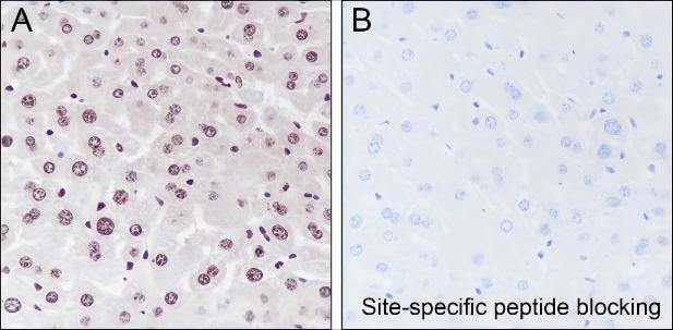 Recombinant Histone H3 (Mono Methyl Lys23) Monoclonal Antibody - small - 3