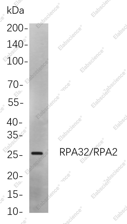 Recombinant RPA32/RPA2 Monoclonal Antibody - 1