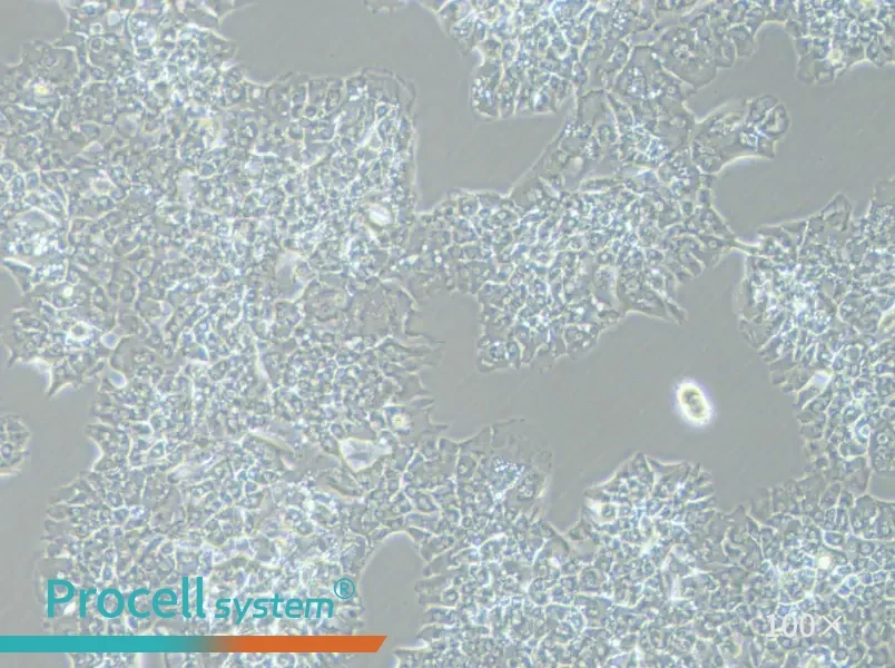 MUG-Chor1 Cell Complete Medium - 2