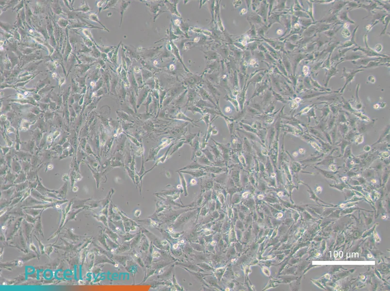 IBRS-2 [IB-RS-2]IBRS-2 [IB-RS-2] - 3