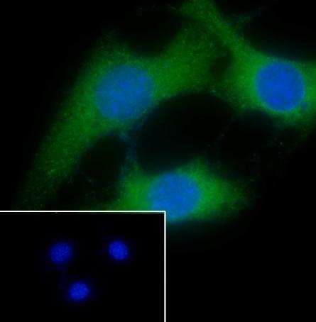 Recombinant Calponin 1 Monoclonal Antibody - small - 6