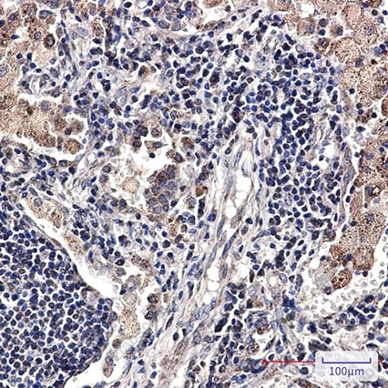 Recombinant SMYD3 Monoclonal Antibody - 3