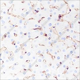Recombinant MHC Class I Monoclonal Antibody - 2