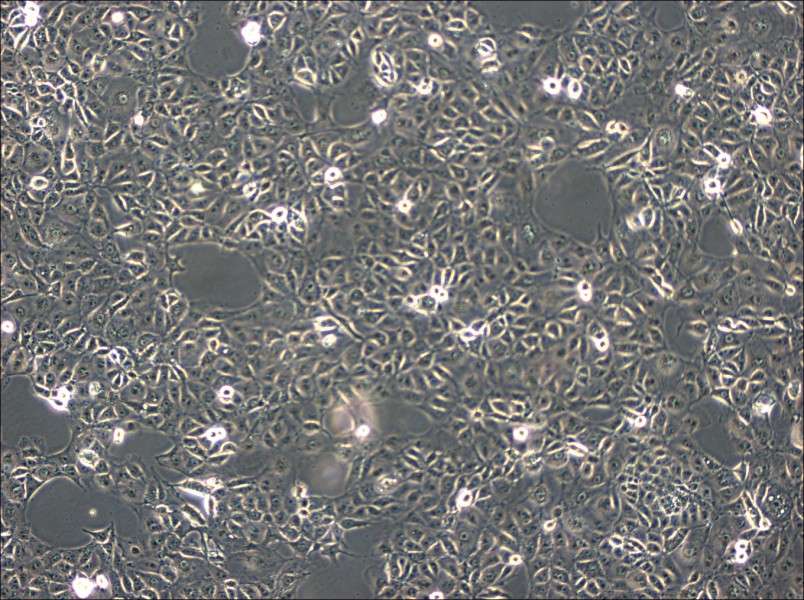 ST Cell Complete Medium - 2