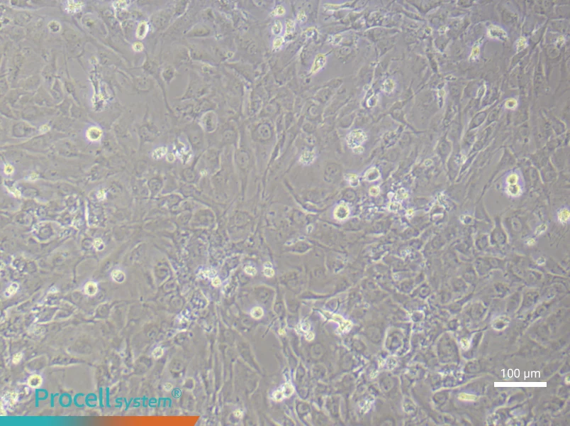 Human Synovial Fibroblast (Primary cell immortalization) Complete MediumHuman Synovial Fibroblast (Primary cell immortalization) Complete Medium - 1