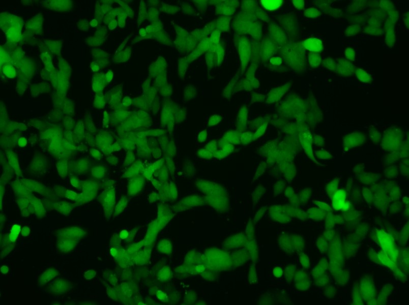 NCI-H446-LUC-EGFP Cell Complete Medium-searchlist-1