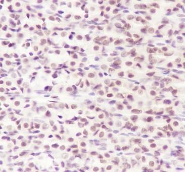 Recombinant Topoisomerase I Monoclonal Antibody - 3