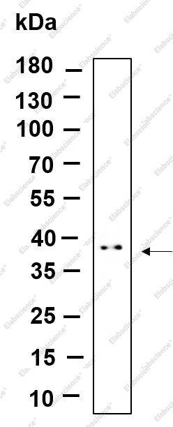 Recombinant STML2 Monoclonal Antibody - 1