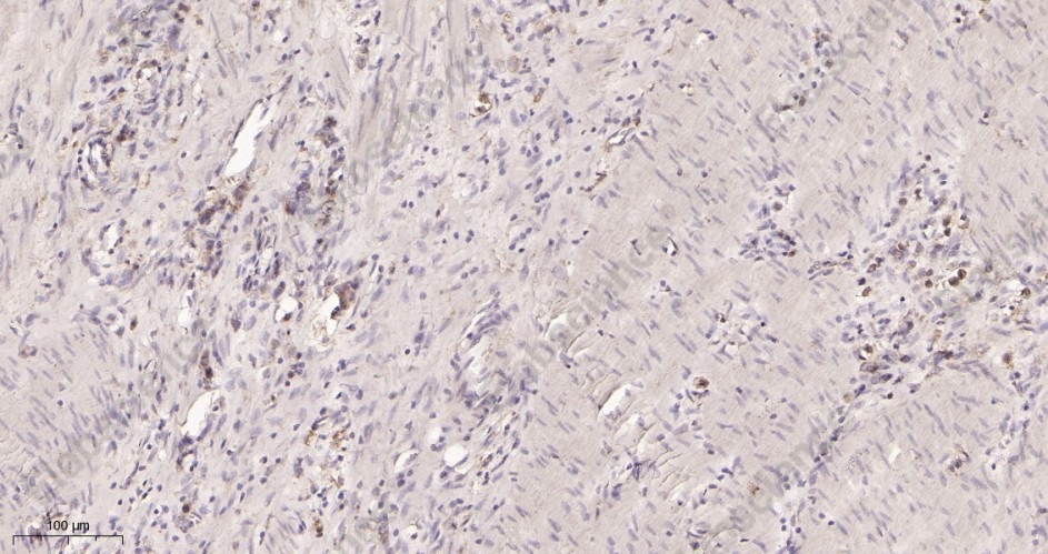 Recombinant VEGF Receptor 1 Monoclonal Antibody - 2
