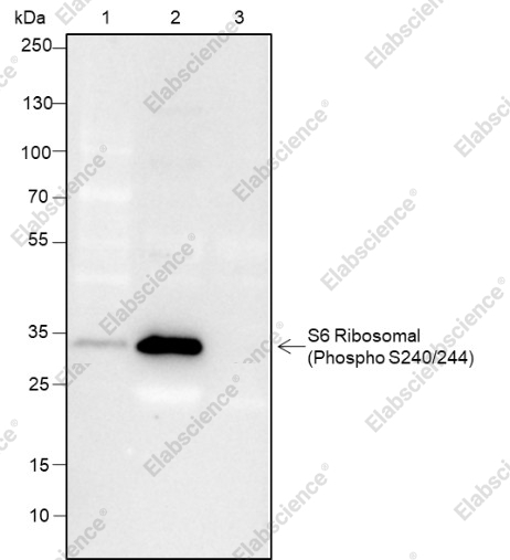 Recombinant Phospho-S6 Ribosomal Protein (Ser240, 244) Monoclonal Antibody - 8