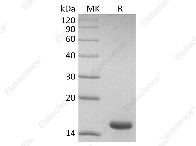 Recombinant SARS-CoV-2 NP CTD domain Protein - 1