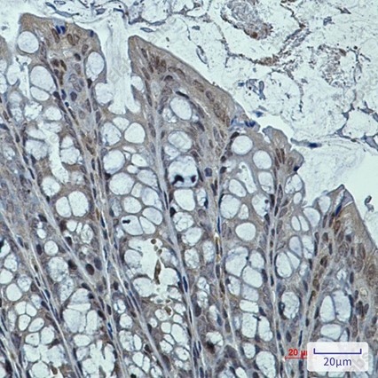 Recombinant DNAJB6 Monoclonal Antibody - 2