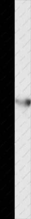 KCNA5 Polyclonal Antibody - 1