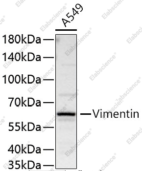 (KO Validated) Vimentin Polyclonal Antibody - 9