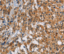 SMAD9 Polyclonal Antibody - 2