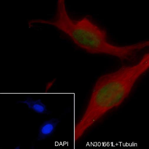 Recombinant SOX11 Monoclonal Antibody - 3