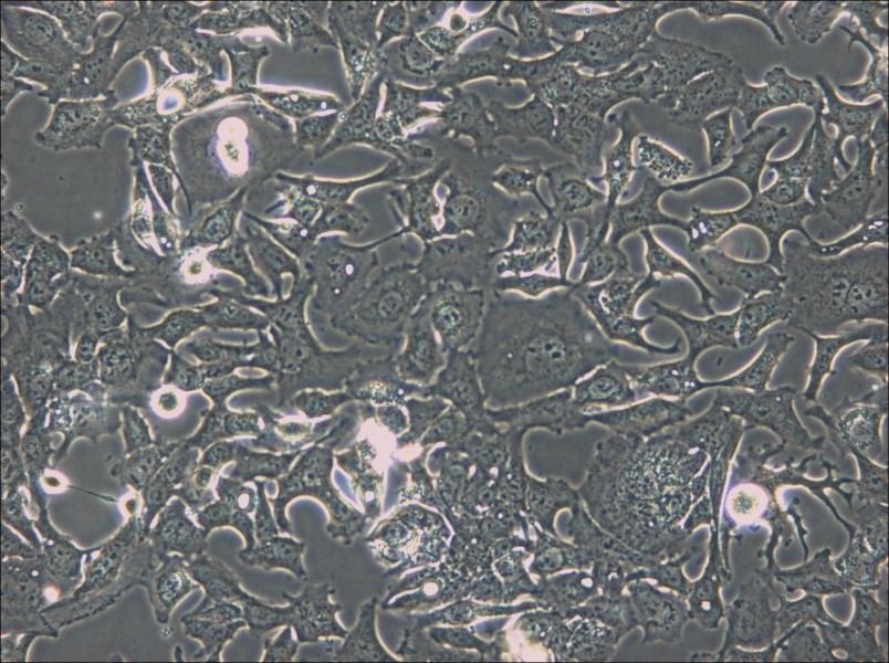 HCC1954 Cell Complete Medium - 5