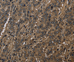 GSTO1 Polyclonal Antibody - 2