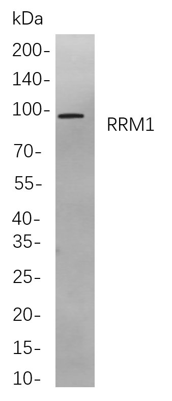 Recombinant RRM1 Monoclonal Antibody-searchlist-1