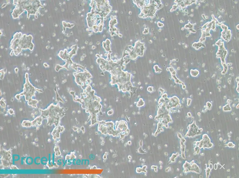 NCI-H209 [H209] Cell Complete Medium - 1