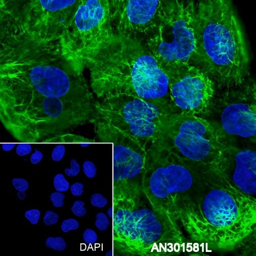 Recombinant Keratin 5/6 Monoclonal Antibody - small - 6