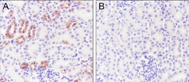 Recombinant Phospho-IKB alpha (Ser32, Ser36) Monoclonal Antibody - small - 4