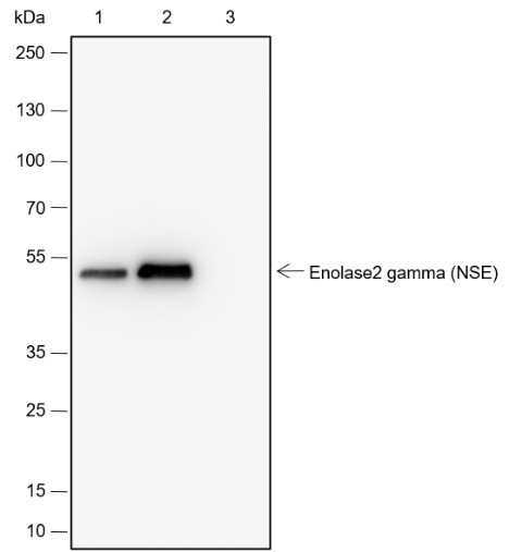 Recombinant NSE Monoclonal Antibody - small - 7